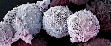 T细胞：没有时间死去——在抗击病毒、细菌和恶性细胞的最前沿