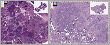 约翰霍普金斯大学：抗寄生虫药物减缓小鼠胰腺癌